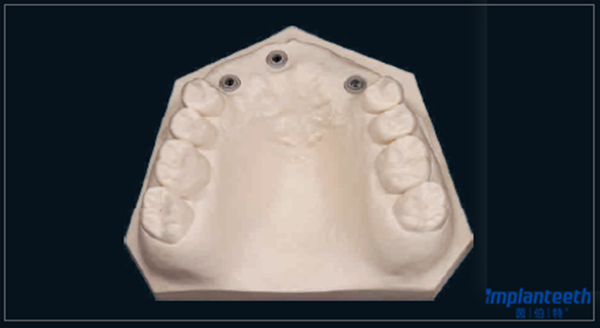 见过石膏模型和3d打印模型您见过切削口腔模型么